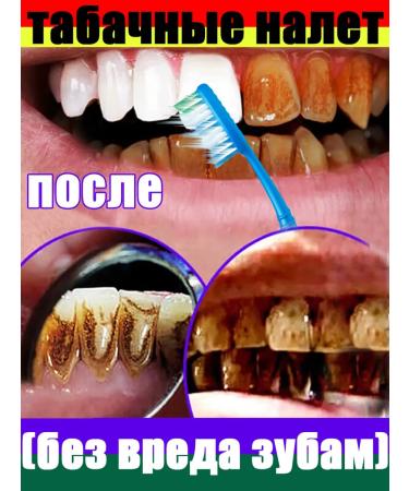 Toothpaste Filler with probiotics-giving raids