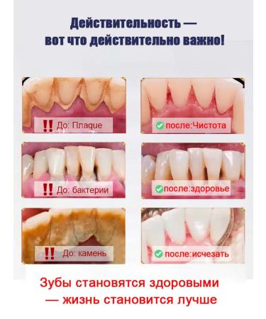 Toothpaste Filler with probiotics-giving raids - Buy Online on GoSupps.com