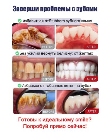 Toothpaste Filler with probiotics-giving raids - Buy Online on GoSupps.com