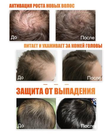 LYDIMOON Women's hair shampoo nourishes the scalp - Buy Online on GoSupps.com