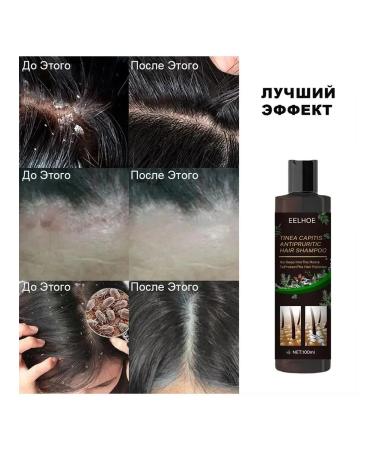 eelhoe Removing dandruff Antizate shampoo reduce the loss - Buy Online on GoSupps.com