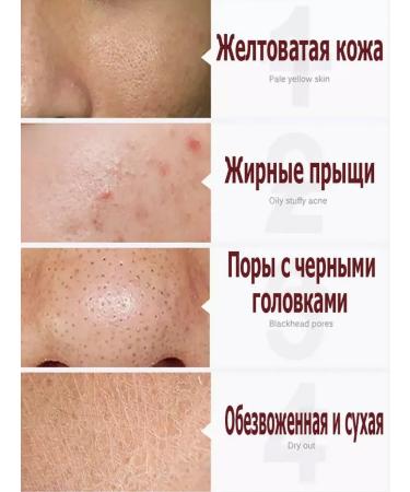 Face mask from black dots of acne and acne 80 g deep oh ... - Buy Online on GoSupps.com