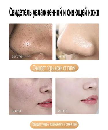 Face mask from black dots of acne and acne 80 g deep oh ... - Buy Online on GoSupps.com