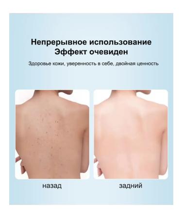 IUALLURE Shower gel against acne and ticks 300 ml - Buy Online on GoSupps.com