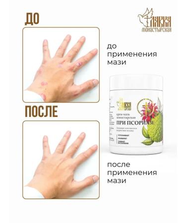 Monastery shop Monastic ointment from psoriasis and skin diseases 3pcs - Buy Online on GoSupps.com