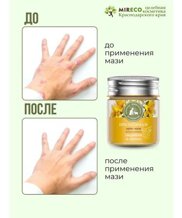 Caucasian Pharmacy Ointment for psoriasis for the legs and body tar and St. John's wort - Buy Online on GoSupps.com