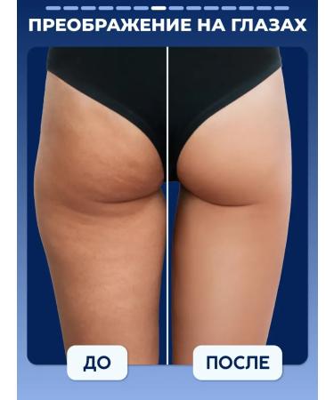 Semily Cold wrap anti -cellulite for weight loss - Buy Online on GoSupps.com