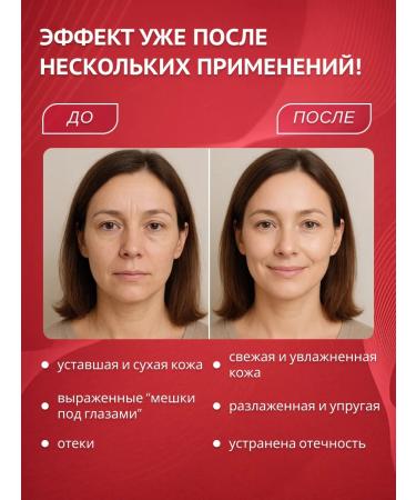 MILOLIKA Eye cream from wrinkles anti -aging sea collagen 45+ - Buy Online on GoSupps.com