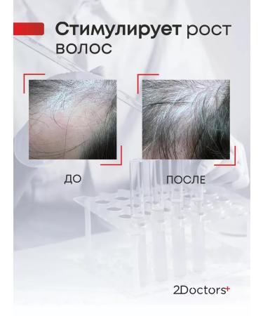 CosmetimaskLabs Hair mask from falling out and for growth