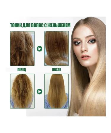 Ouhoe ginseng hair growth scalp entity reduces loss100ml - Buy Online on GoSupps.com