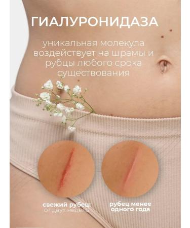 DRSKINVITA Get rid of stretch marks - Buy Online on GoSupps.com