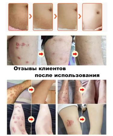 DRSKINVITA Get rid of stretch marks - Buy Online on GoSupps.com