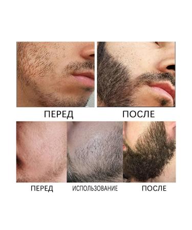 East moon set of essences for the care of a beard - Buy Online on GoSupps.com