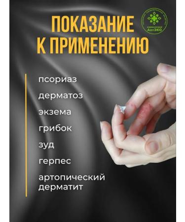 Caucasian Pharmacy Set of ointment for body psoriasis 3pcs - Buy Online on GoSupps.com