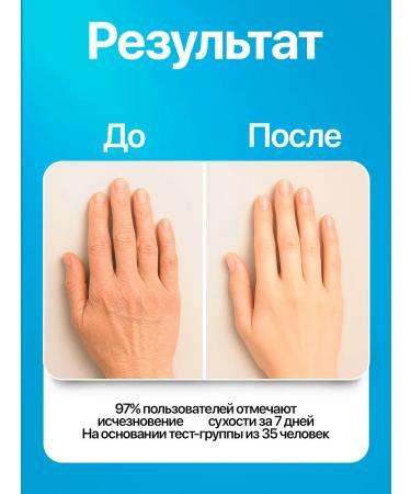 Moisturizing hand and body cream with urea and vitamin E - Buy Online on GoSupps.com