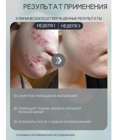 Paula's Choice Cleaning face tonic 118 ml - Buy Online on GoSupps.com