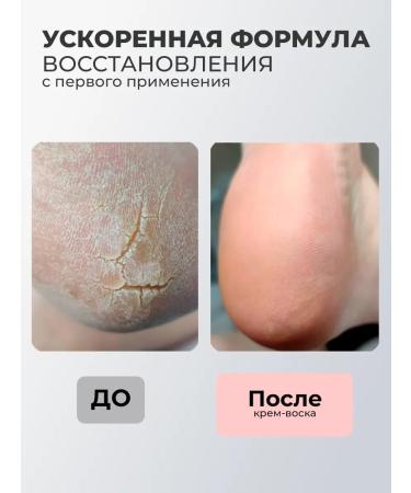 ROSILAK Cream-mask for legs from cracks and dryness moisturizing - Buy Online on GoSupps.com