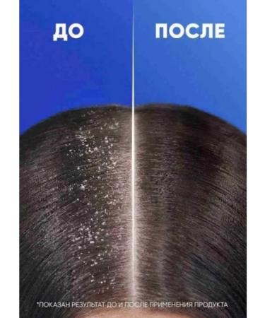 Head & Shoulders Original shampoo Clean & Balance 300ml - Buy Online on GoSupps.com