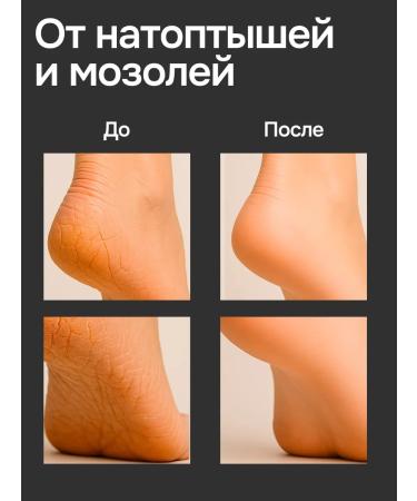 Fu Lie Ling Fulelin cream for very dry skin of the feet with urea for cracks 3 pcs. - Buy Online on GoSupps.com