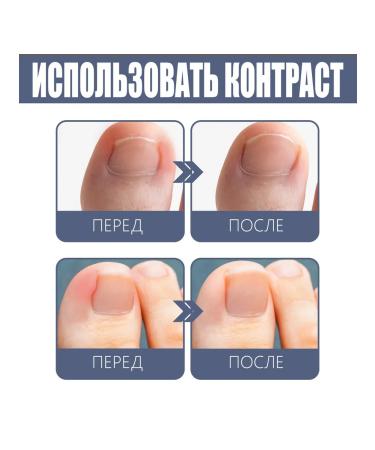 Nail restoration disinfection - Buy Online on GoSupps.com