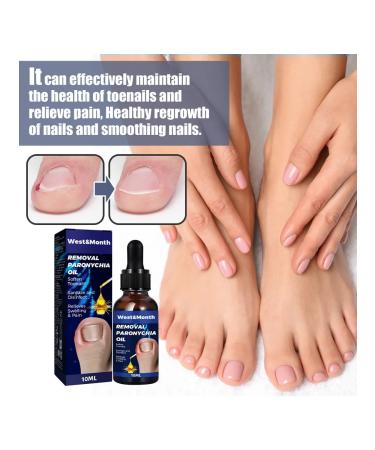 West & Month Grown Noga on the toe Oil for caring for ... - Buy Online on GoSupps.com