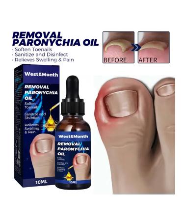 West & Month Grown Noga on the toe Oil for caring for ... - Buy Online on GoSupps.com
