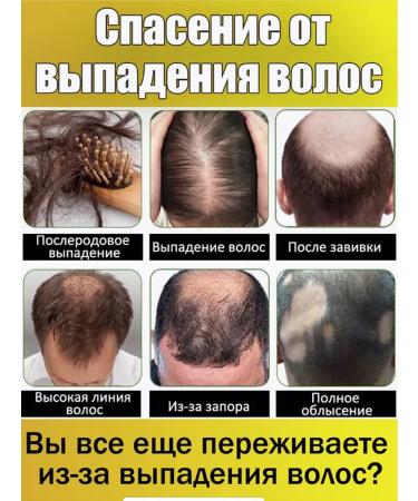 LYDIMOON Hair growth shampoo against falling out from fat content - Buy Online on GoSupps.com