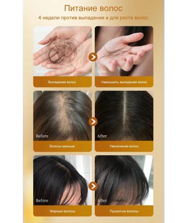 LYDIMOON Hair growth shampoo against falling out from fat content - Buy Online on GoSupps.com