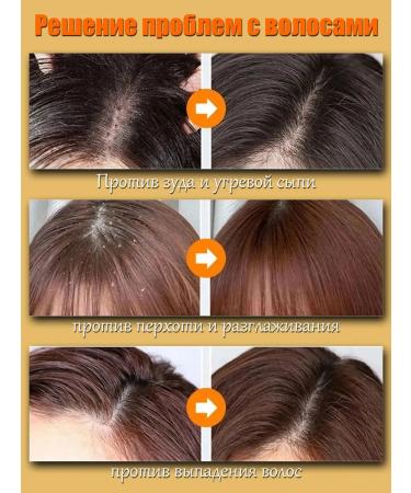 LYDIMOON Hair growth shampoo against falling out from fat content - Buy Online on GoSupps.com