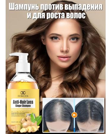 LYDIMOON Anti-hair loss anti-dandruff and hair growth shampoo