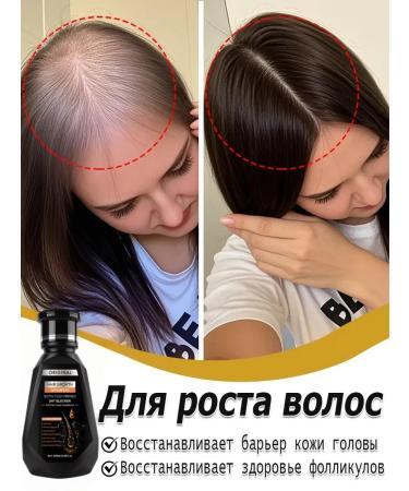 DRSKINVITA 250 ml of shampoo against hair loss
