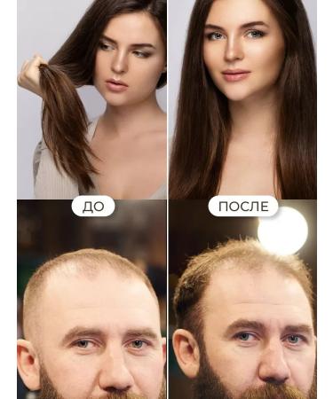 DRSKINVITA 250 ml of shampoo against hair loss - Buy Online on GoSupps.com