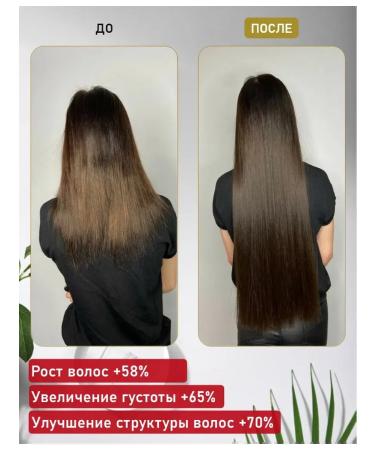 DRSKINVITA 250 ml of shampoo against hair loss - Buy Online on GoSupps.com