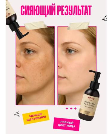 IOFFE Face cream intensively moisturizer with urea 150 ml - Buy Online on GoSupps.com