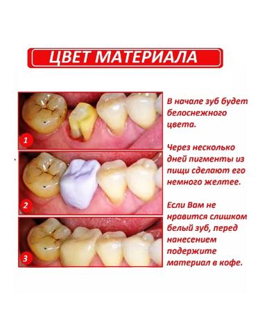 Affordable dentistry Imitation tooth material 30ml - Buy Online on GoSupps.com