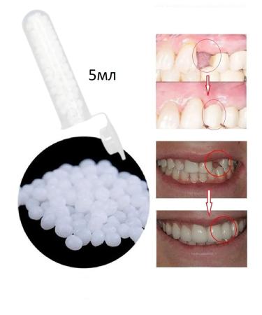 Affordable dentistry Imitation tooth material 5 ml - Buy Online on GoSupps.com