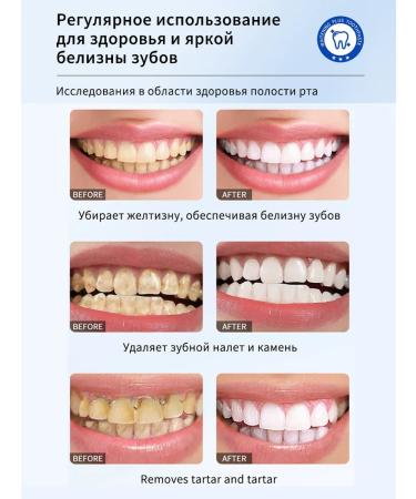 LYDIMOON Whitening toothpaste from plaque tea coffee and tobacco 100g - Buy Online on GoSupps.com