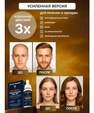 minox-boost The same 15% for hair growth and beard (1 bottle) - Buy Online on GoSupps.com