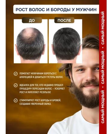 minox-boost The same 15% for hair growth and beard - Buy Online on GoSupps.com