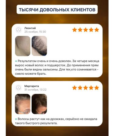 minox-boost The same 15% for hair growth and beard 2 vials - Buy Online on GoSupps.com