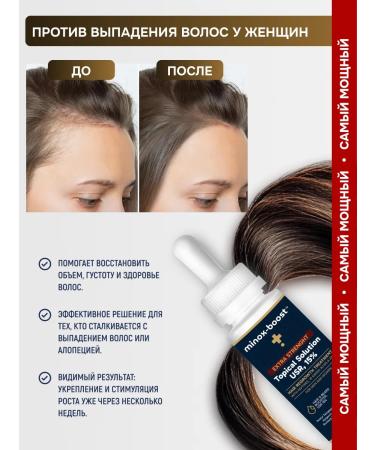 minox-boost The same 15% for hair growth and beard 2 vials - Buy Online on GoSupps.com