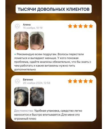 minox-boost The same 15% for hair growth and beard 3 bottles - Buy Online on GoSupps.com