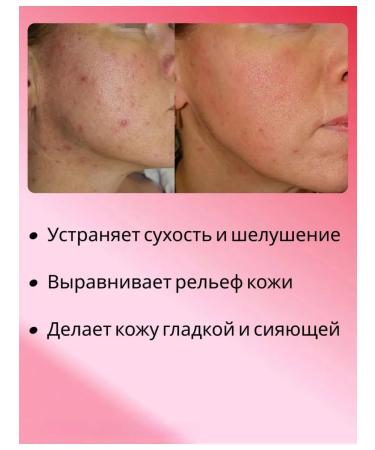 KSecret Facial Cream SEUL 1988 Cream Snail Mucin 93% + Rice - Buy Online on GoSupps.com