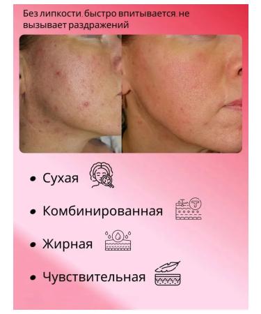 KSecret Facial Cream SEUL 1988 Cream Snail Mucin 93% + Rice - Buy Online on GoSupps.com