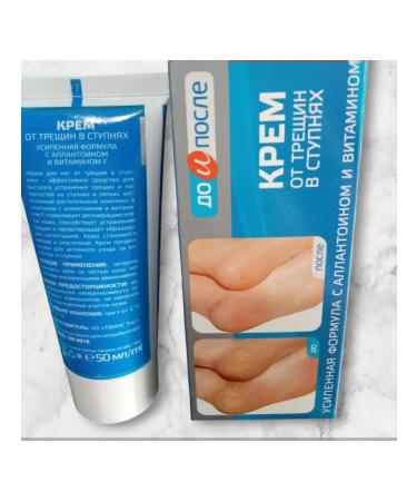 Cream from cracks in the feet before and after - Buy Online on GoSupps.com