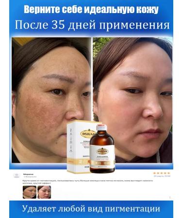 Serum with niacinamide for bleaching pigment spots - Buy Online on GoSupps.com