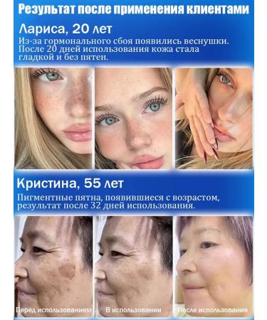 Serum with niacinamide for bleaching pigment spots - Buy Online on GoSupps.com