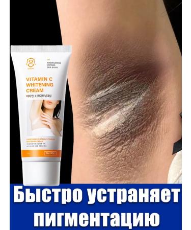 Whitening cream for intimate zones and body body.