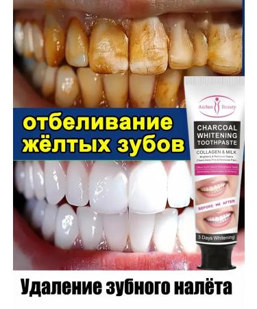 DRSKINVITA 100 g of whitening toothpaste