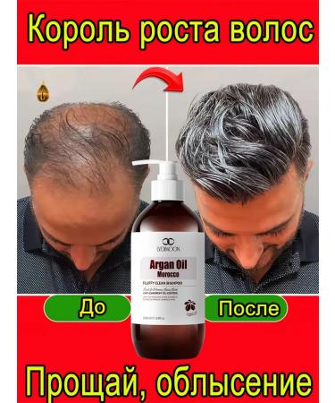 LYDIMOON hair shampoo rapid growth stimulation - Buy Online on GoSupps.com